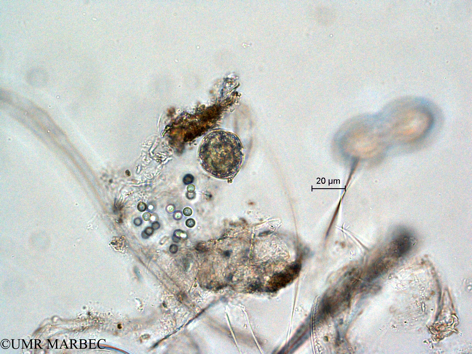 phyto/Scattered_Islands/all/COMMA April 2011/Aphanocapsa sp2 et Scrippsiella spp (1)(copy).jpg